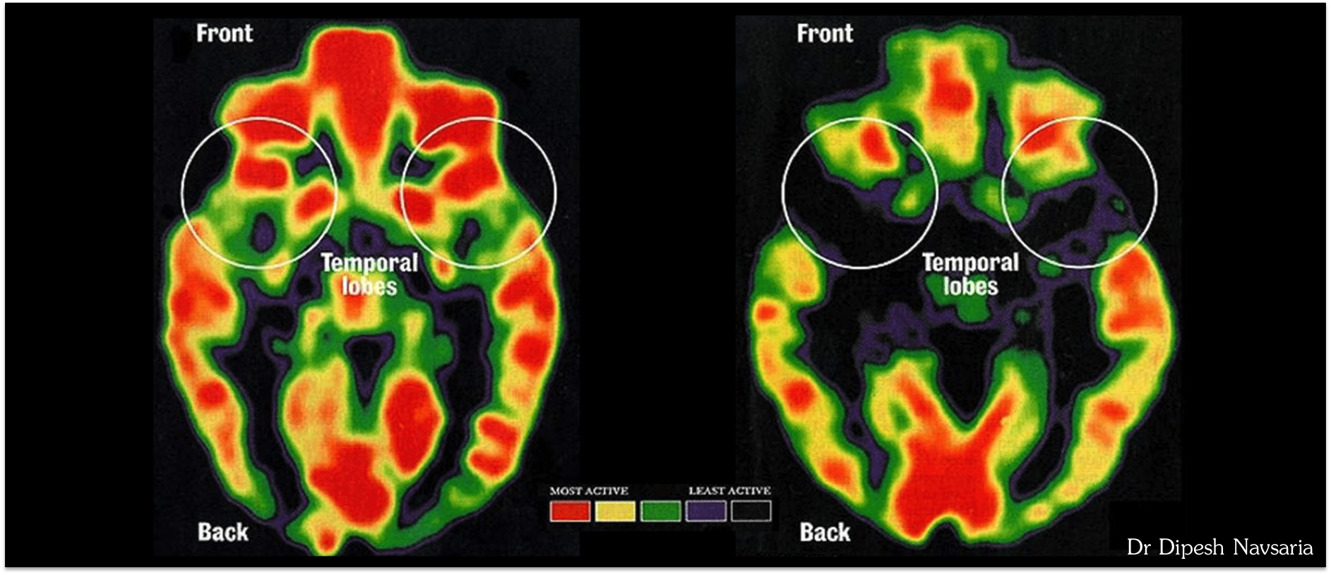 two-brain-scans-meshguides